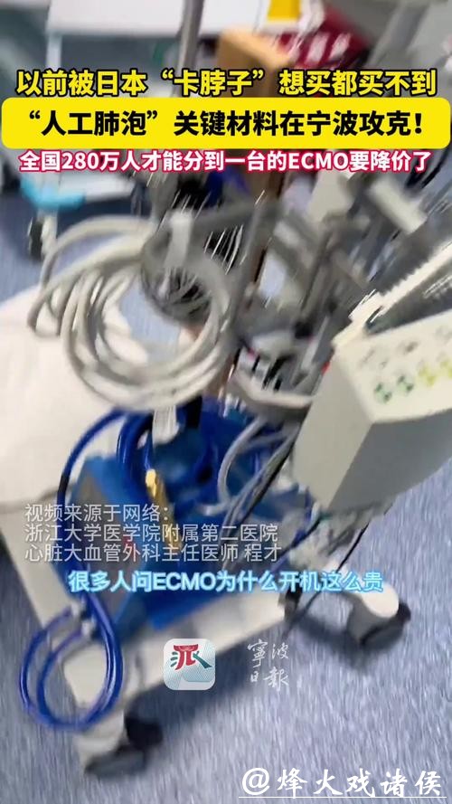 百万元的“人工肺”,宁波攻克关键材料 百万元的“人工肺”,宁波攻克关键材料